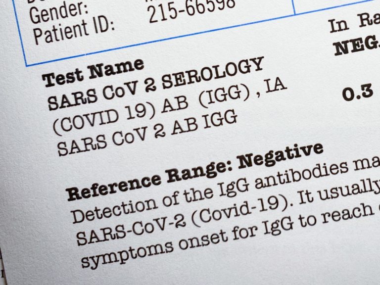 How Do I Get My COVID-19 Test Results? | MainStreet Family Care