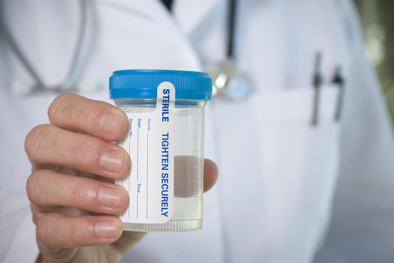 Common Urine Lab Tests at Urgent Care Centers, drug test 