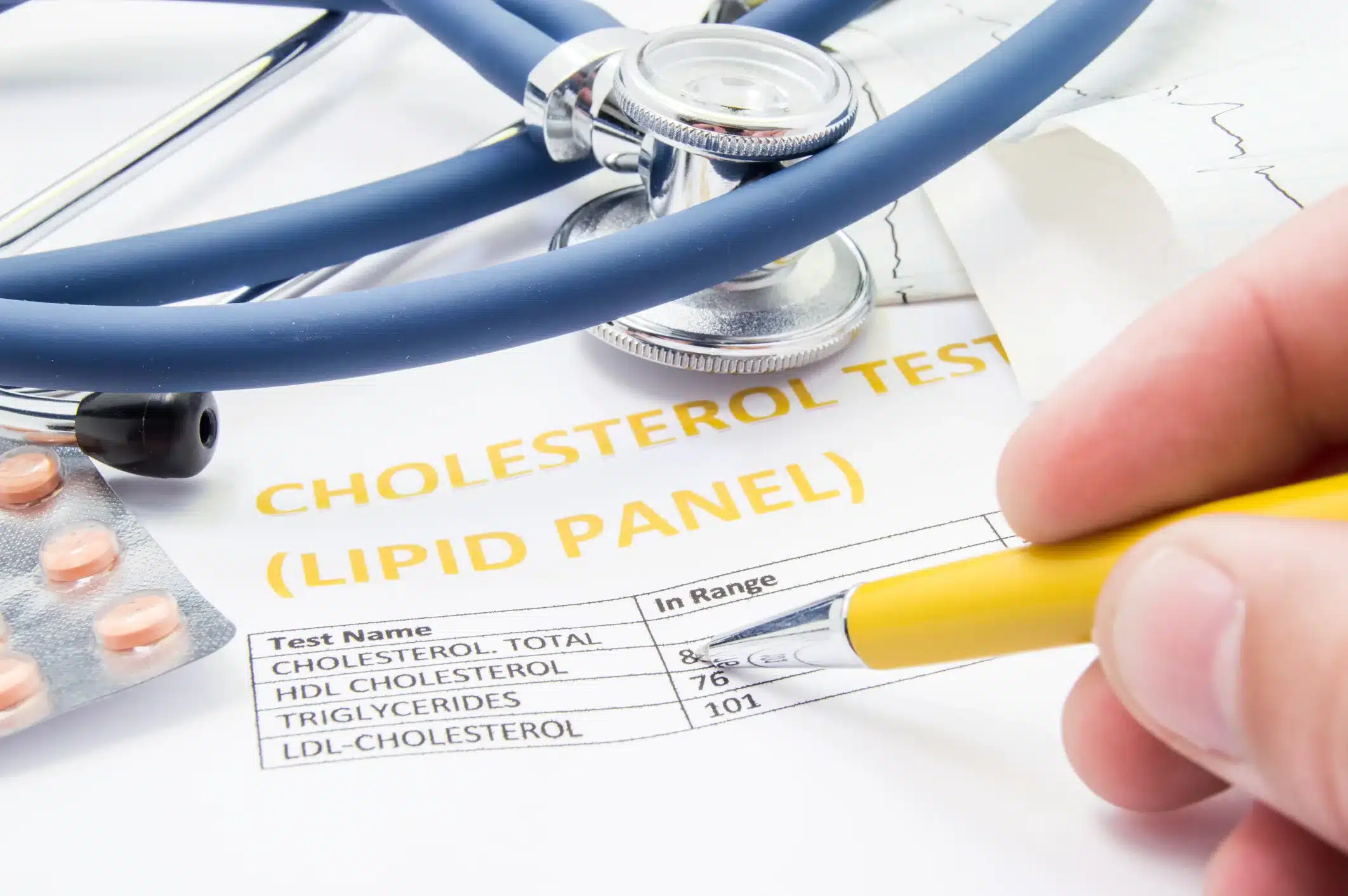 Cholesterol test results displayed with medicine and stethoscope.